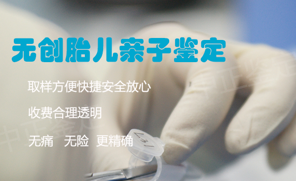 无锡怀孕15周能做产前亲子鉴定吗, 无锡怀孕15周能做产前亲子鉴定吗,